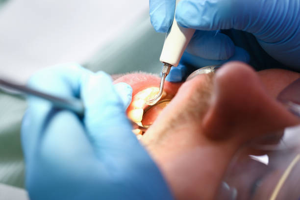 Best Emergency Dental Surgery in Lexington, VA
