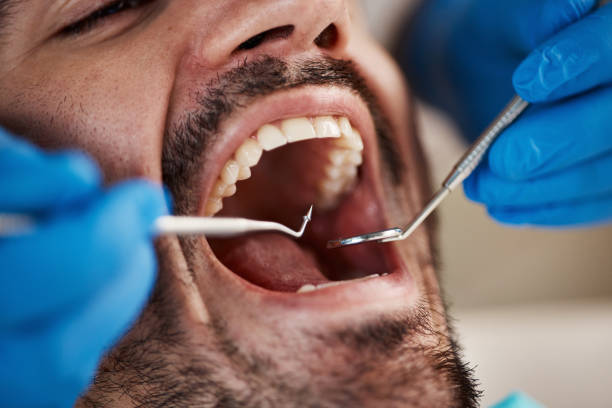 Best After-Hours Emergency Dentist in Lexington, VA